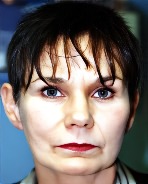 photo facelift before